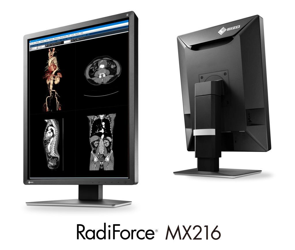 Imagen: El monitor RadiForce MX216 de dos megapíxeles (Foto cortesía de EIZO)