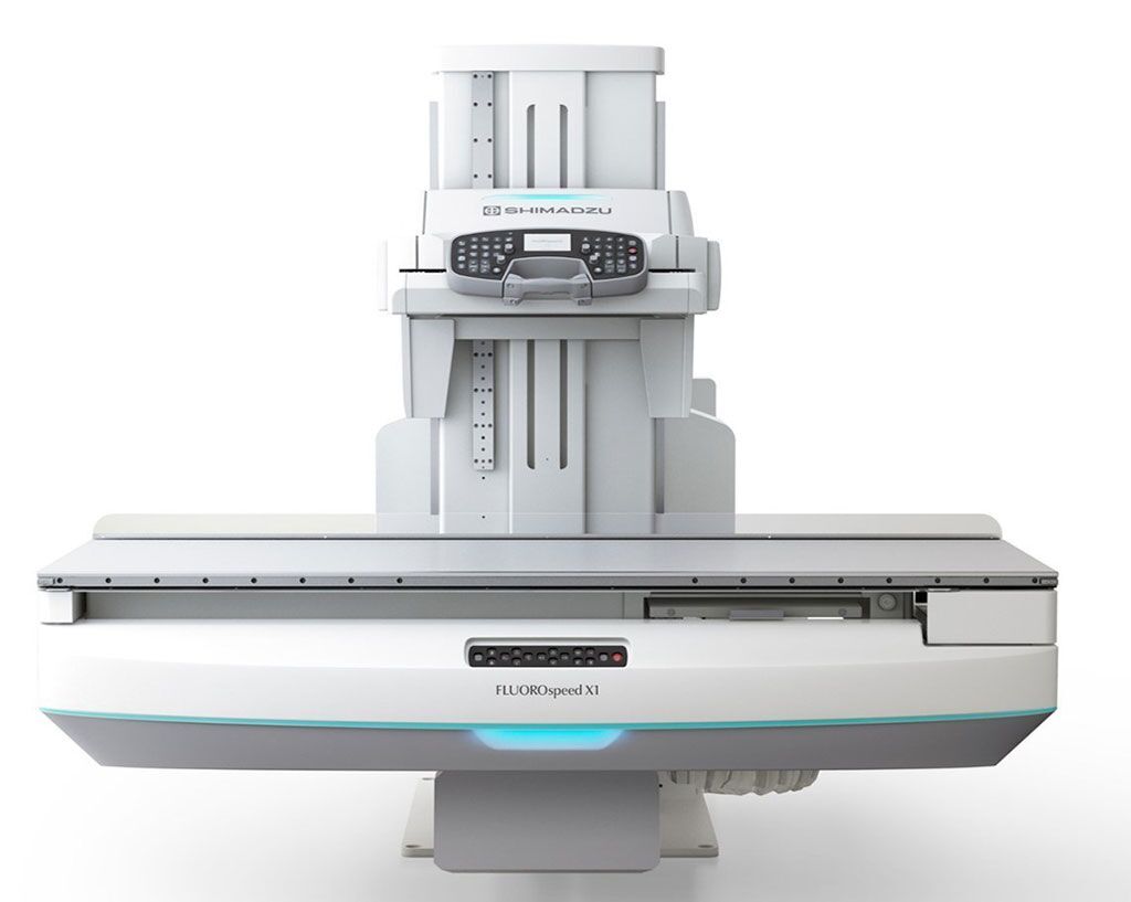 Imagen: El sistema de RF FluoroSpeed X1 edition (Fotografía cortesía de Shimadzu Medical Systems)