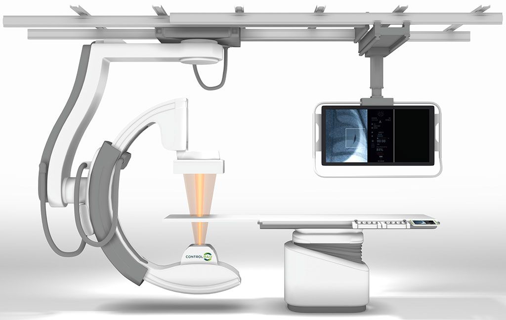 Imagen: El ControlRad Select optimiza el haz de rayos X para reducir la radiación en un 85% (Fotografía cortesía de ControlRad)