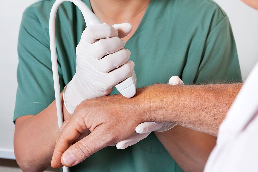 Imagen: El ultrasonido puede identificar con precisión los desgarros de los tendones en la mano (Fotografía cortesía de Shutterstock)