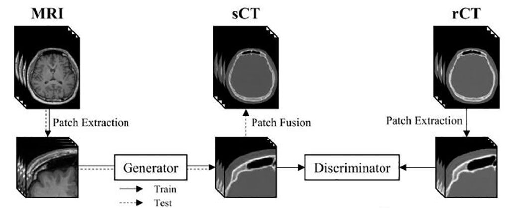 Imagen: Diagrama esquemático del flujo de entrenamiento y prueba de las TC sintéticas (Fotografía cortesía de KIST)