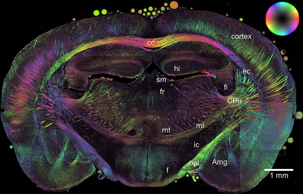 Imagen: escaneo de imágenes con luz polarizada en 3D del cerebro de un ratón (Fotografía cortesía de Axer, Amunts et al. / INM-1, Forschungszentrum Jülich)