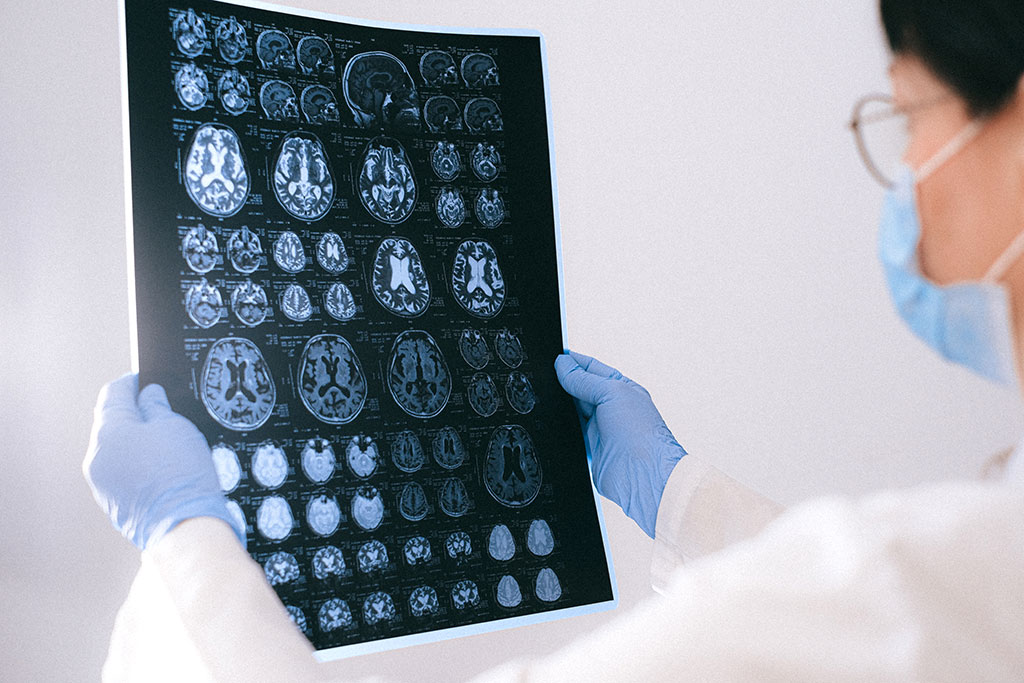 Imagen: Investigación para mapear el cerebro para detectar el Alzheimer antes (Fotografía cortesía de Pexels)