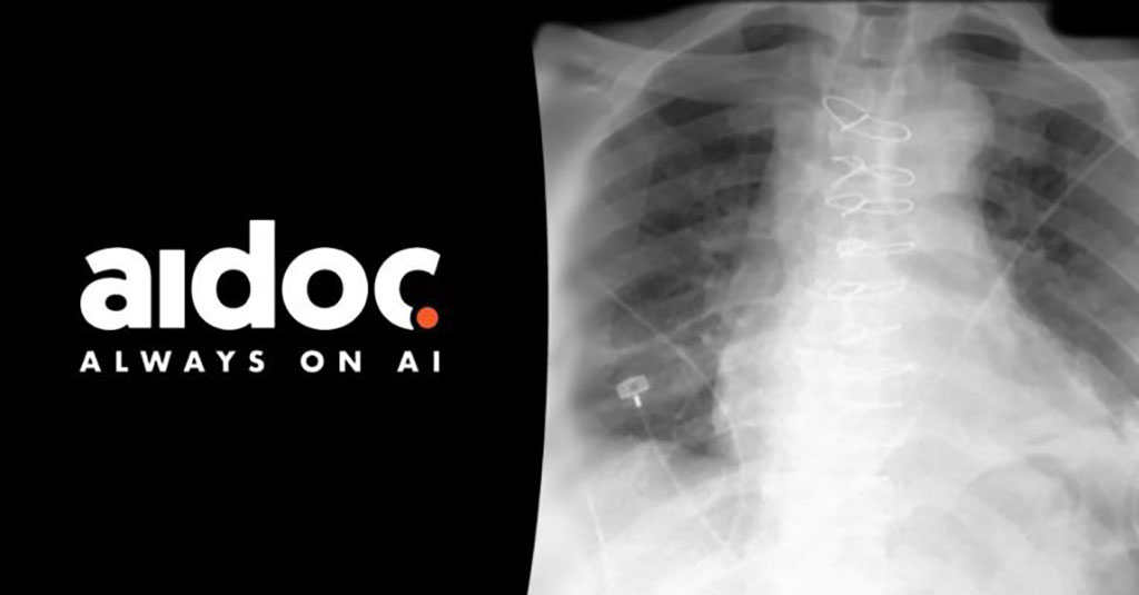 Imagen: Aidoc recibió la autorización 510(k) de la FDA para su clasificación y notificación de neumotórax en exámenes de rayos X (Fotografía cortesía de Aidoc)