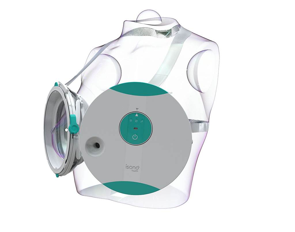 Imagen: El sistema Atusa es el primer ultrasonido de seno 3D automatizado y portátil del mundo (Fotografía cortesía de iSono Health)