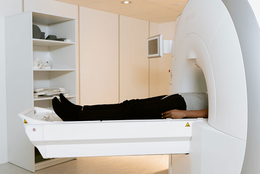 Imagen: La fMRI se puede usar como método no invasivo para predecir complicaciones en la enfermedad hepática crónica (Fotografía cortesía de Pexels)