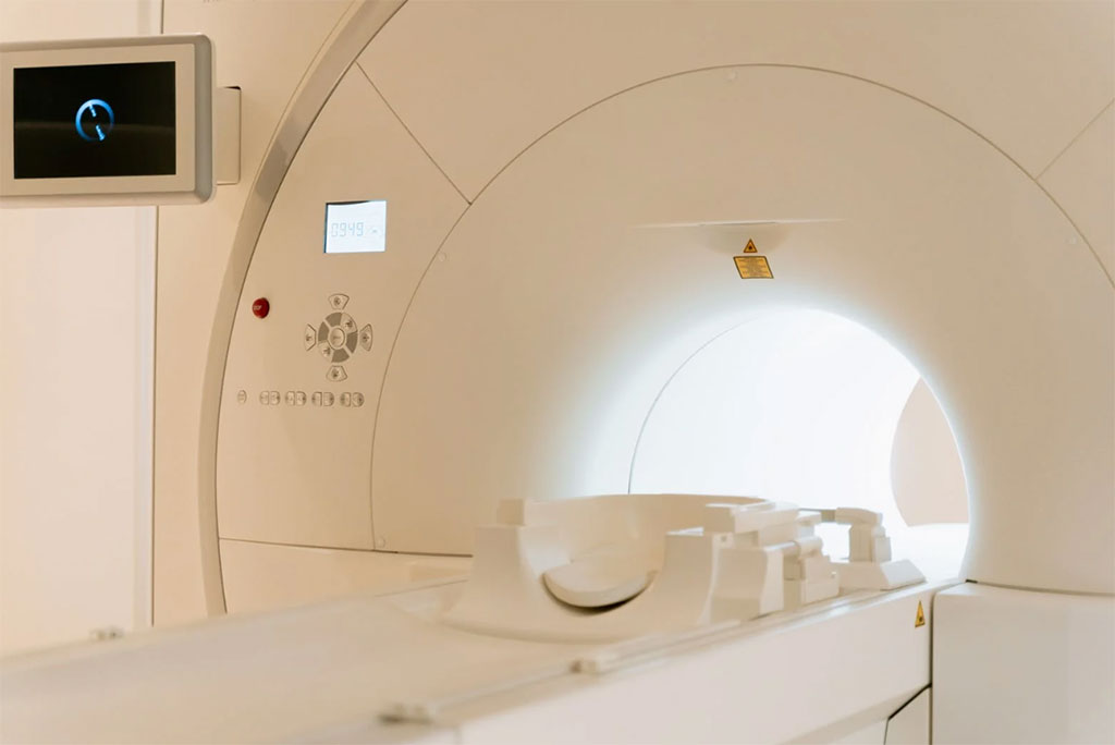 Imagen: Algunos pacientes hospitalizados con accidente cerebrovascular isquémico pueden beneficiarse de la resonancia magnética además de la TC inicial (Fotografía cortesía de Pexels)