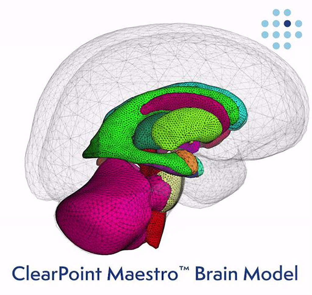 Imagen: ClearPoint Maestro Brain Model ha recibido la autorización de la FDA (Fotografía cortesía de ClearPoint Neuro)