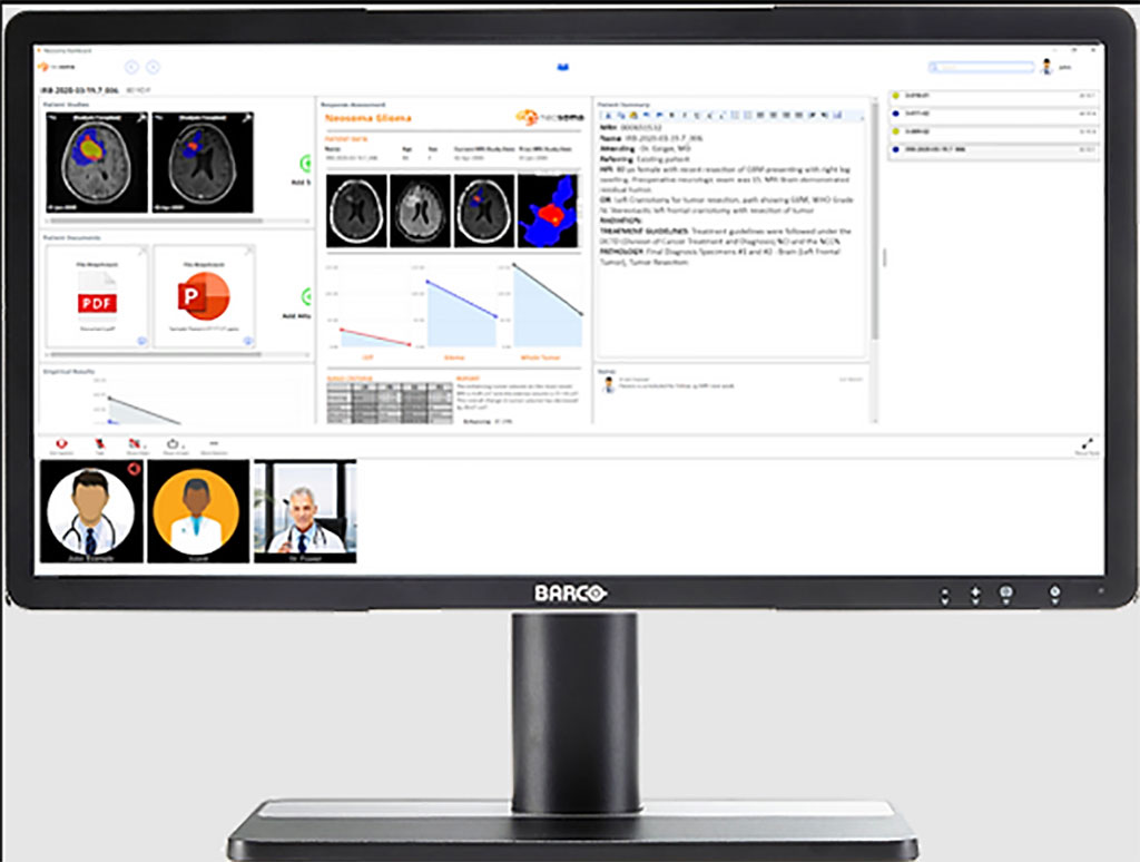 Imagen: Neosoma HGG es el primer software de neuro-oncología basado en IA en recibir la autorización 510 (k) de la FDA (Fotografía cortesía de Neosoma)