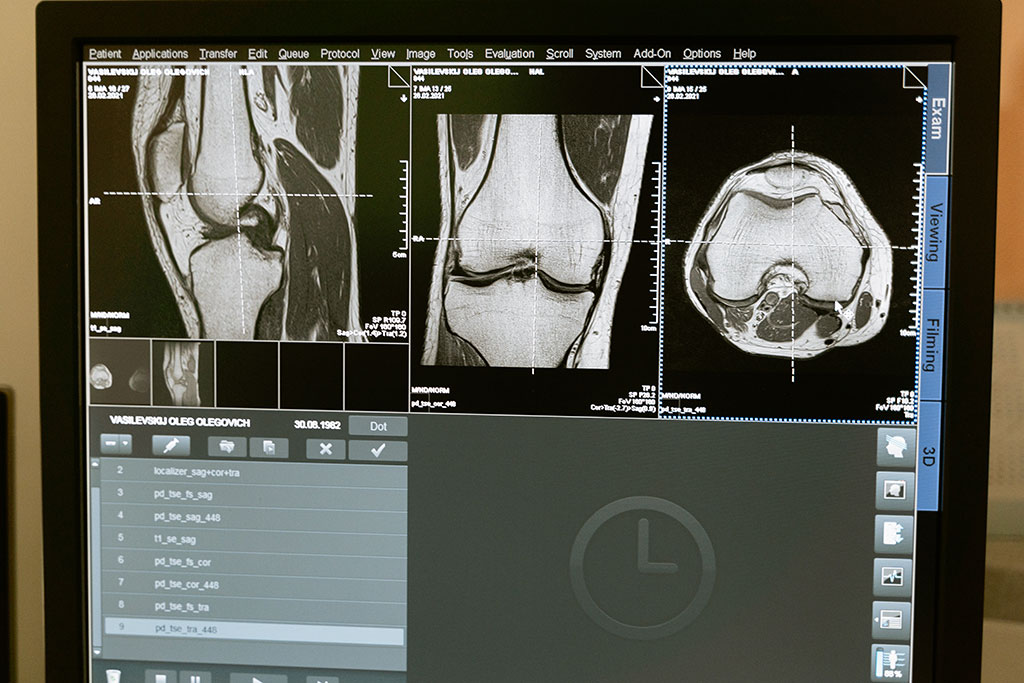 Imagen: La nueva técnica de imagen ósea podría conducir a un mejor tratamiento de la osteoporosis (Fotografía cortesía de Pexels)