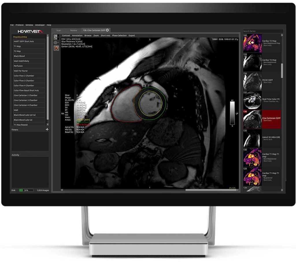Imagen: One Click MRI es una plataforma solo de software que controla directamente los escáneres de resonancia magnética (Fotografía cortesía de Vista.ai)