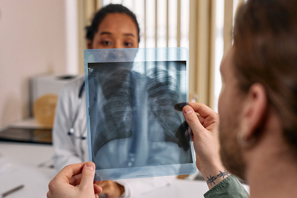 Imagen: El software basado en IA mejora significativamente la detección de nódulos pulmonares en las radiografías de tórax (Fotografía cortesía de Pexels)