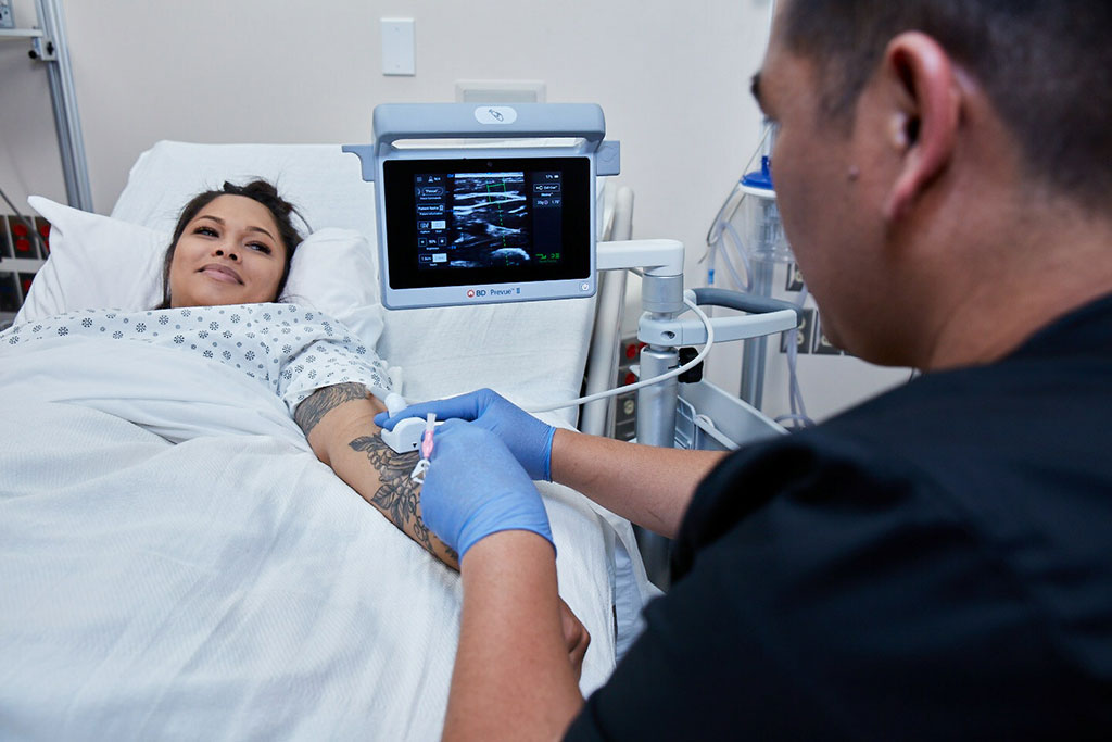 Imagen: El sistema BD Prevue II utiliza tecnología de ultrasonido conectada para impulsar la colocación y control intravenosa más intuitivos (Fotografía cortesía de BD)