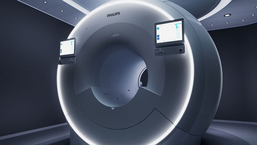 Imagen: El innovador sistema MR 7700 agrega capacidades de xenón para mejorar las imágenes de ventilación (Fotografía cortesía de Philips)