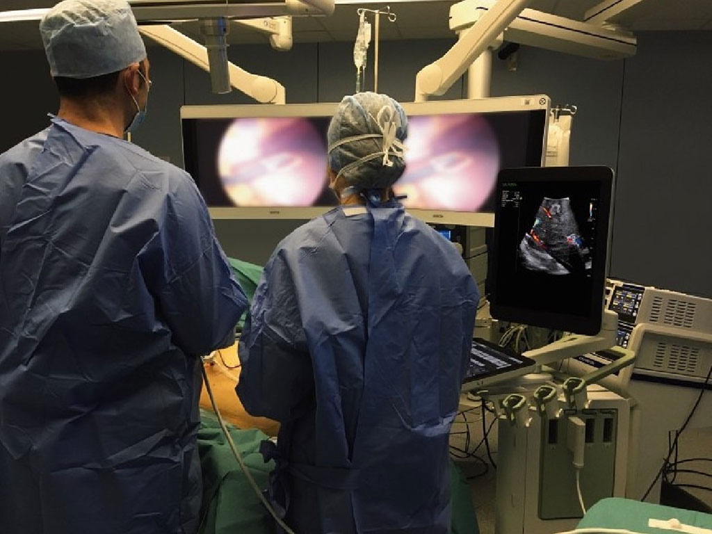 Imagen: El sistema de ultrasonido bkActiv se ha ampliado a muchos más tipos de procedimientos en el quirófano (Fotografía cortesía de GE HealthCare)