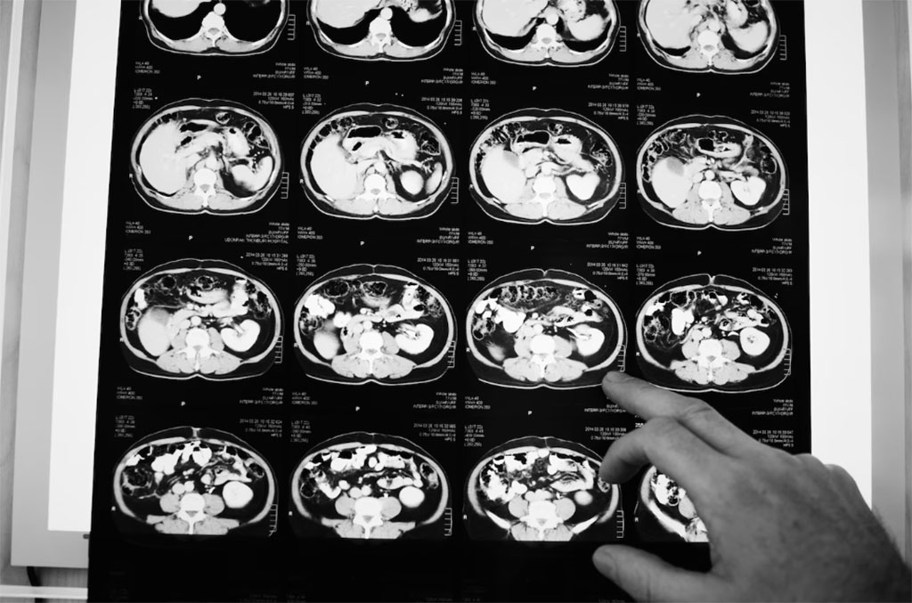 Imagen: La nueva técnica de resonancia magnética que captura el impacto de la COVID-19 en el cerebro también podría detectar cánceres de seno y próstata (Fotografía cortesía de Freepik)
