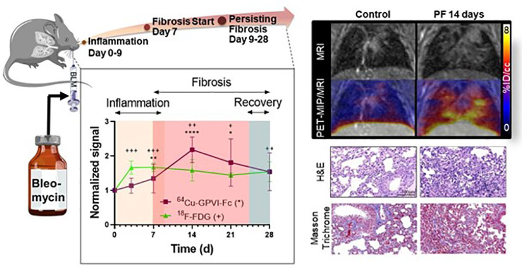 Imagen: Imágenes moleculares preclínicas de la progresión de la fibrosis pulmonar (Fotografía cortesía del Hospital Universitario Tübingen)