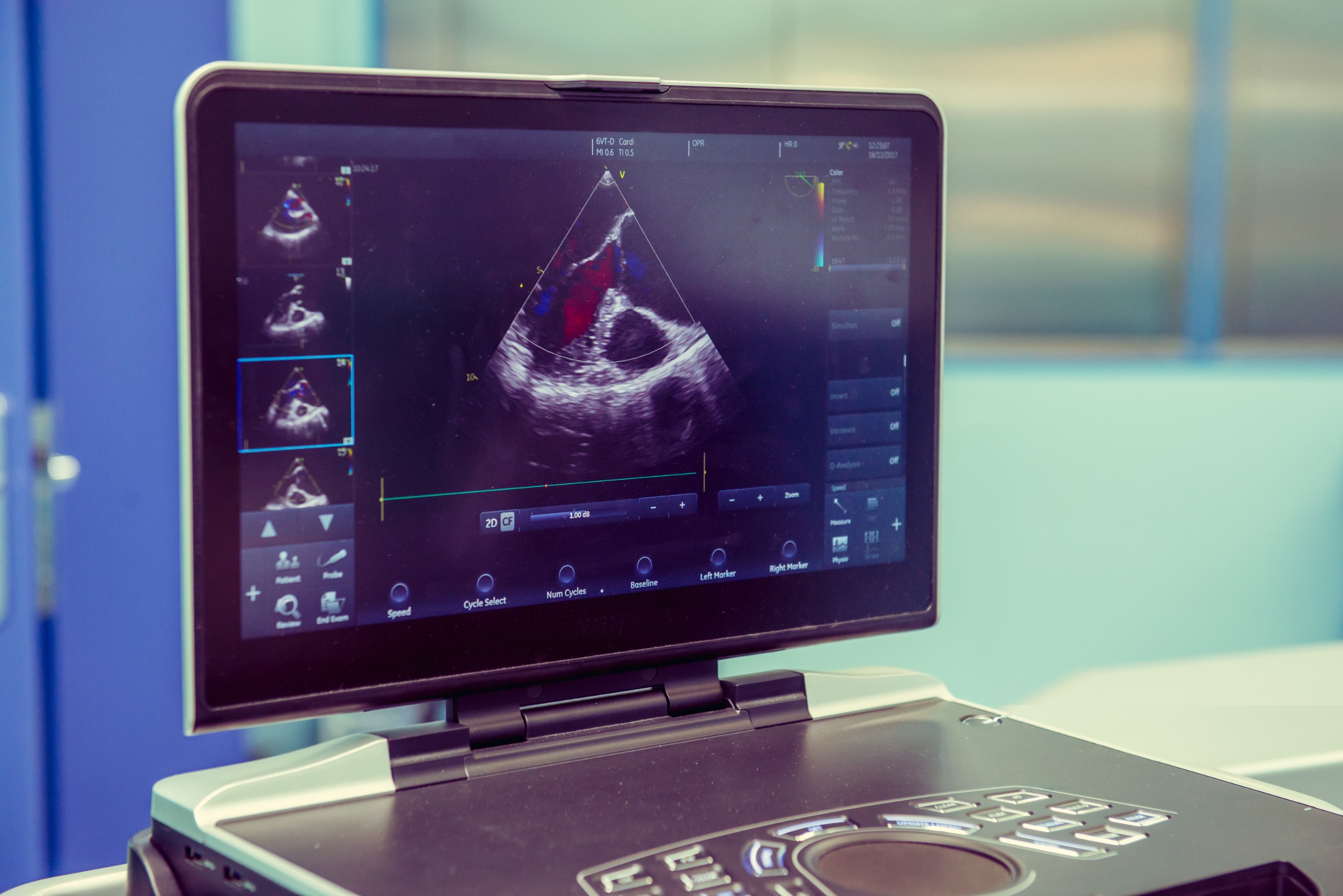 Imagen: La inteligencia artificial automatiza el diagnóstico de la enfermedad de la válvula cardíaca grave (Fotografía cortesía de 123RF)