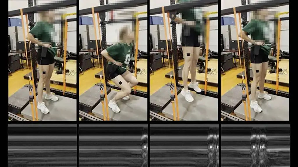 Imagen: Un monitor de ultrasonido portátil puede proporcionar información sobre el movimiento muscular dinámico durante las actividades como saltar (Fotografía cortesía de FIU)