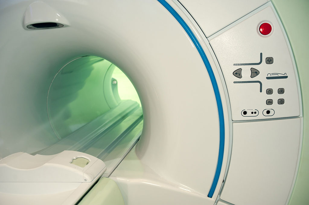 Imagen: La radioterapia puede mejorar la función cardíaca al reducir las células inmunes inflamatorias (Fotografía cortesía de 123RF)