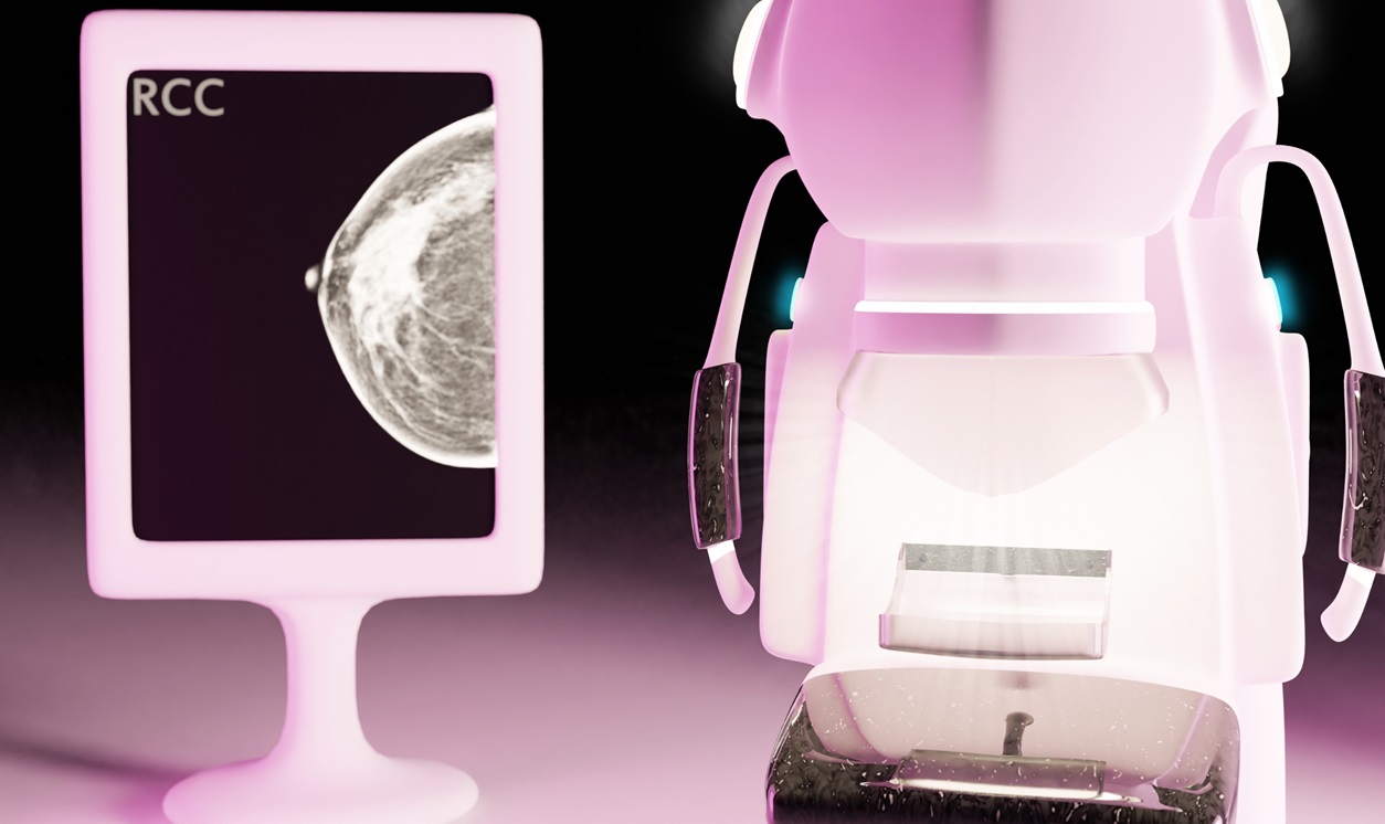Imagen: El modelado de IA detecta y clasifica las microcalcificaciones de mama (Fotografía cortesía de 123RF)