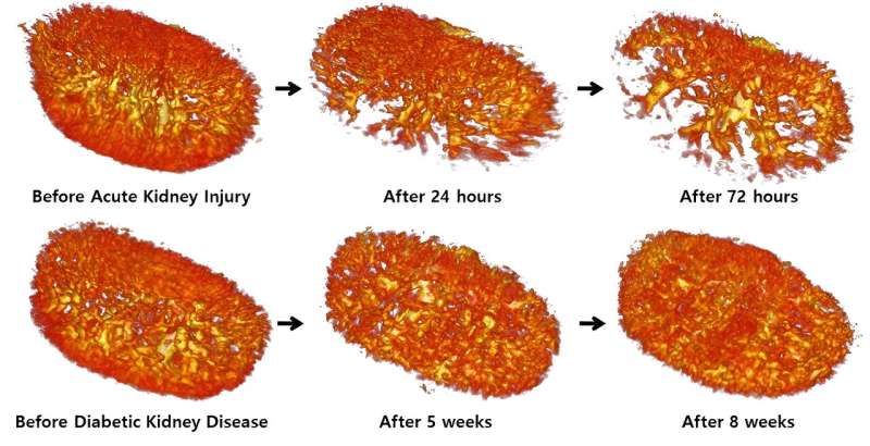 Imagen: Cambios vasculares en la insuficiencia renal aguda y diabética (Fotografía cortesía de POSTECH)