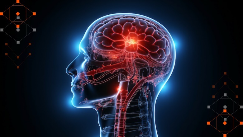 Imagen: La IA puede predecir si los pacientes con cáncer cerebral sobrevivirán más de 8 meses después de recibir tratamiento con radioterapia (Fotografía cortesía de KCL)