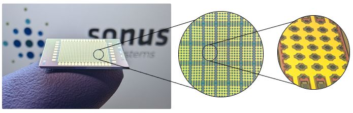 Imagen: La tecnología de ultrasonido remoto promete revolucionar las imágenes de diagnóstico (Fotografía cortesía de Sonus Microsystems)