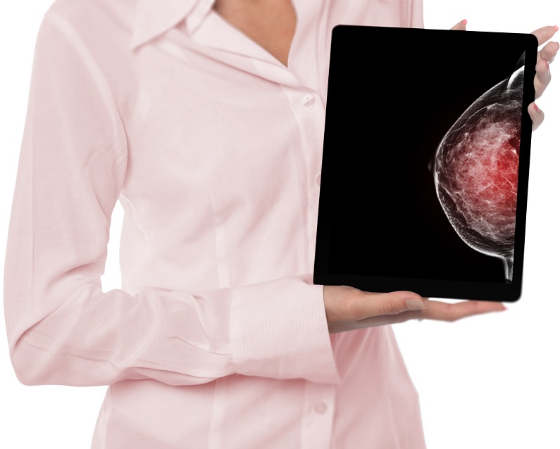 Imagen: El uso de la resonancia magnética abreviada en la detección de mamas de alto riesgo ha estado ganando impulso (Fotografía cortesía de 123RF)