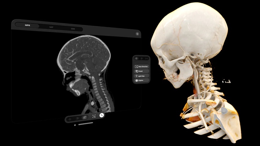 Imagen: La aplicación Cinematic Reality permite la interacción con representaciones realistas de la anatomía humana (Fotografía cortesía de Siemens)
