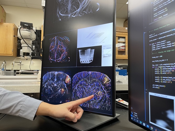 Imagen: La imagen de ultrasonido de una región del cerebro que muestra una fuerte actividad de microburbulentas a partir de una prueba de estimulación nerviosa (foto cortesía de la Universidad de Illinois Urbana-Champaign)