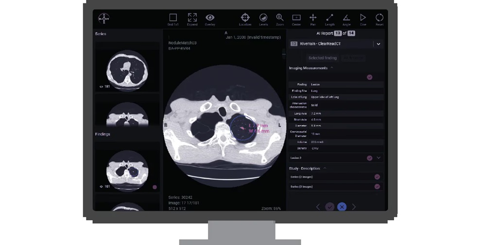 Imagen: Calantic Digital Solutions  es una suite coordinada de soluciones de radiología basadas en IA que tiene como objetivo transformar la radiología (Foto cortesía de Bayer)