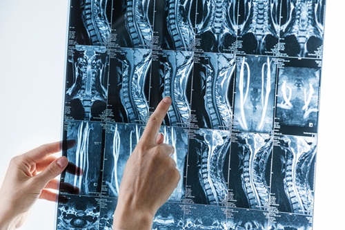 Imagen: La IA reduce significativamente los tiempos de interpretación de la resonancia magnética de la columna lumbar (foto cortesía de 123RF)