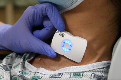 Imagen: FloPatch es el primer ultrasonido Doppler del mundo que ayuda a mejorar la atención de pacientes con sepsis y shock séptico (foto cortesía de Flosonics Medical)