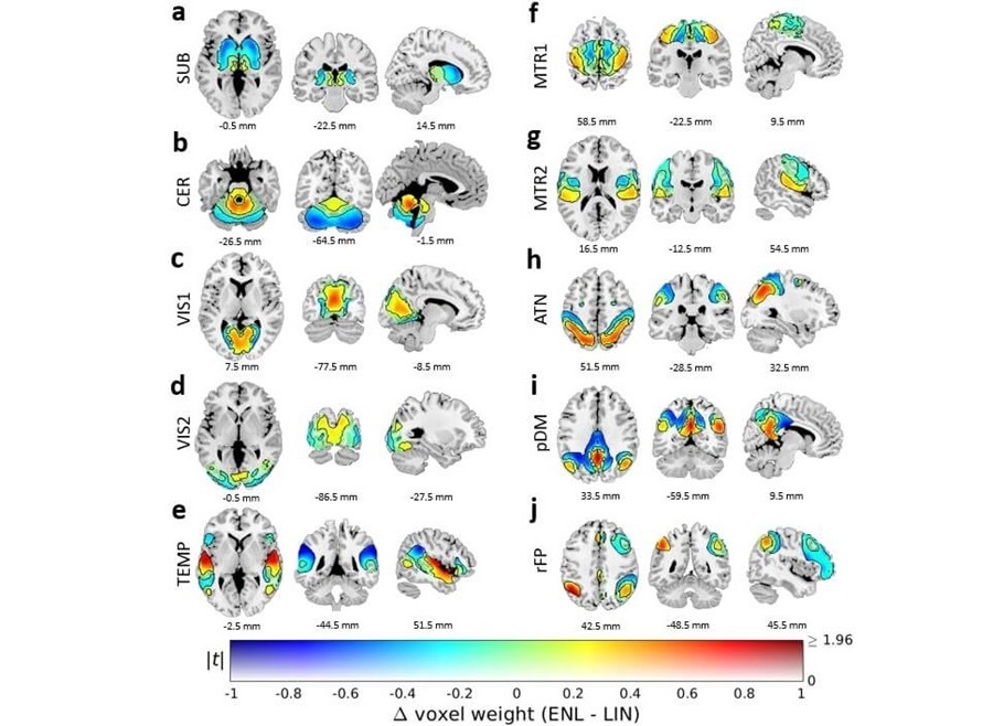 Imagen: Los escáneres revelaron una nueva dimensión de la organización de la red cerebral en humanos (foto cortesía de la Universidad Estatal de Georgia/Centro de Investigación TReNDS)