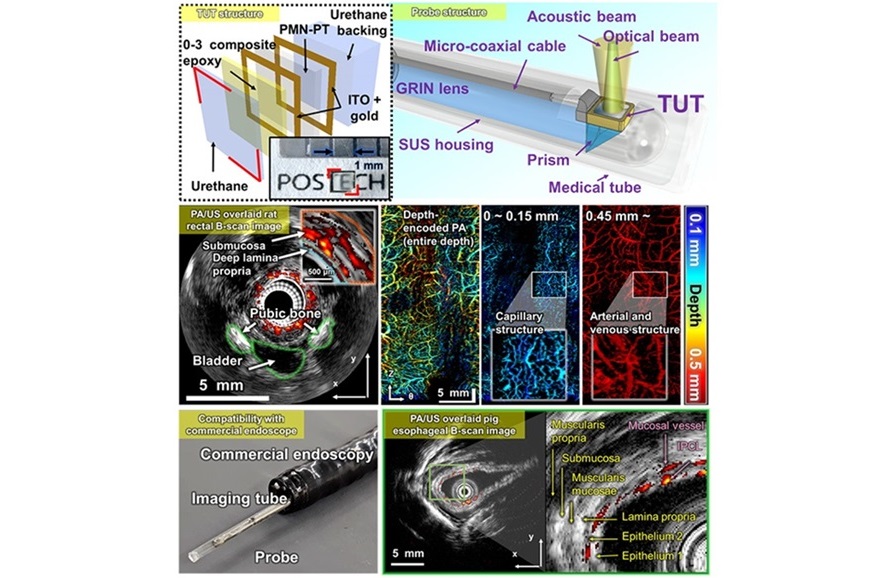 Imagen: Una sonda de fusión fotoacústica-ultrasonido basada en un transductor de ultrasonido transparente, junto con imágenes del recto de una rata y del esófago de un cerdo (foto cortesía de POSTECH)