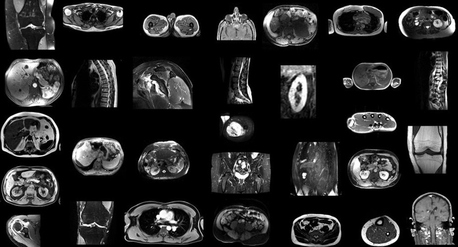 Imagen: Ejemplos de exploraciones de resonancia magnética en el conjunto de datos de entrenamiento (Foto cortesía de Radiology, DOI:10.1148/radiol.241613)