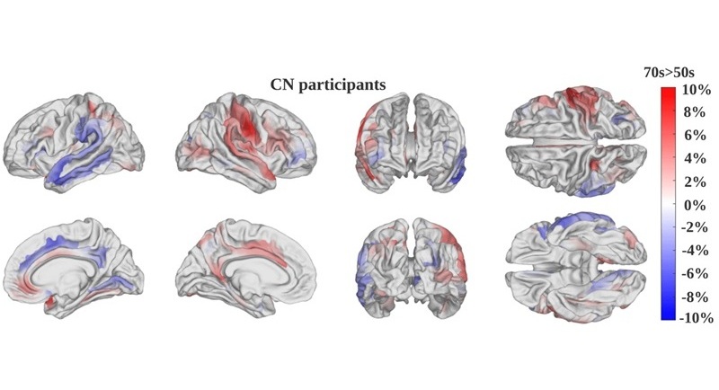 Imagen: Un mapa de prominencia producido por el modelo de IA muestra la diferencia promedio en prominencia entre participantes cognitivamente normales de entre 50 y 70 años. (foto cortesía de Chenzhong Yin/USC)