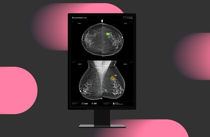 Imagen: la solución de análisis de mamografías impulsada por IA INSIGHT MMG (foto cortesía de Lunit)