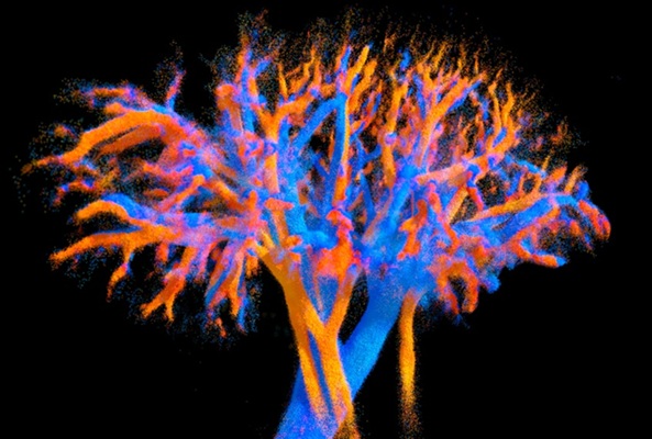Imagen: Visualización de la vascularización de un riñón completo obtenida mediante la sonda multilente (Fotografía cortesía de Alexandre Dizeux, Physics for Medicine/Inserm)