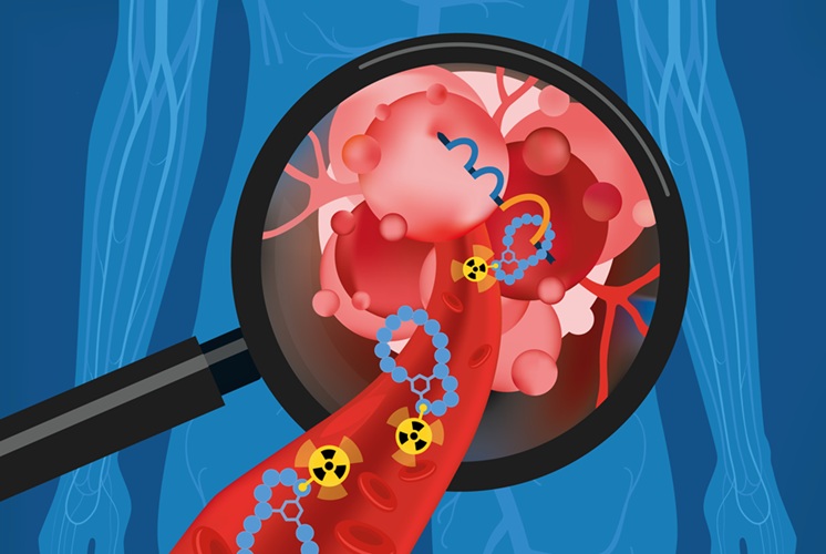 Imagen: esta representación artística ilustra cómo funciona el fármaco candidato NECT-224 en el cuerpo humano (Fotografía cortesía de HZDR/A. Gruetzner)