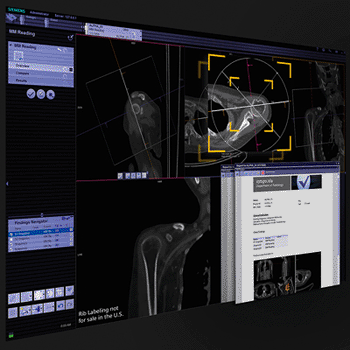 Image: syngo.via General Engine is a new package of highly automated and standardized applications. As depicted here, the feature “Anatomical Range Presets” displays a quick, precise, optimal view of selected anatomical regions. (Photo courtesy of Siemens Healthcare). Image: syngo.via General Engine is a new package of highly automated and standardized applications. As depicted here, the feature “Anatomical Range Presets” displays a quick, precise, optimal view of selected anatomical regions. (Photo courtesy of Siemens Healthcare).