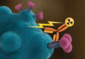Image: Radiolabeled human antibody binds to the viral gp41 protein expressed on the surface of the HIV infected human lymphocyte and the cell is killed by alpha radiation delivered by the antibody (Photo courtesy of RSNA). Image: Radiolabeled human antibody binds to the viral gp41 protein expressed on the surface of the HIV infected human lymphocyte and the cell is killed by alpha radiation delivered by the antibody (Photo courtesy of RSNA).