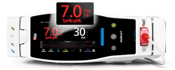 Image: The noninvasive hemoglobin (SpHb) device (Photo image courtesy of Masimo Corp).