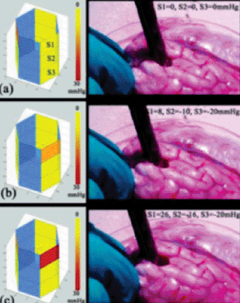 Image: Validating the pressure sensor in an animal model: Feedback on the severity of the applied pressure shows a dark red warning threshold (c) at 30-mmHg lateral pressure (Photo courtesy of Boston Children’s Hospital).
