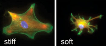 Image: Cell Morpholgy in relation to surface stiffness (Photo courtesy of the University of Cambridge).