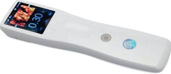 Image: Analogic Sonic Window handheld ultrasound for peripheral IV placement (Photo courtesy of Analogic).