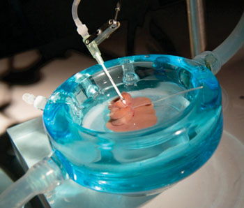Image: A supercooled rat liver in the machine perfusion system (Photo courtesy of Massachusetts General Hospital).