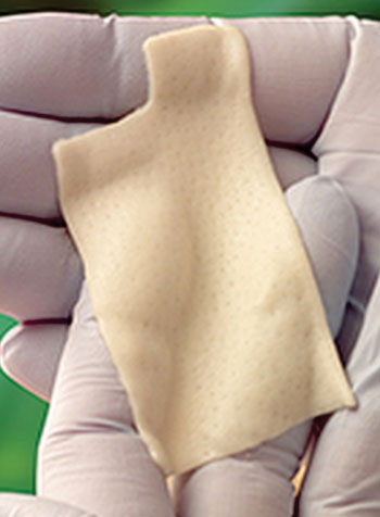Image: DermaPure decellularized human dermis (Photo courtesy of Tissue Regenix).