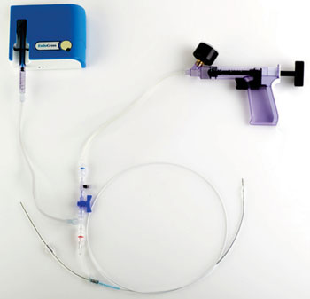 Image: The ENABLER-C Coronary Catheter System (Photo courtesy of EndoCross).